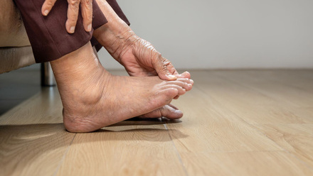 Gout foot pain