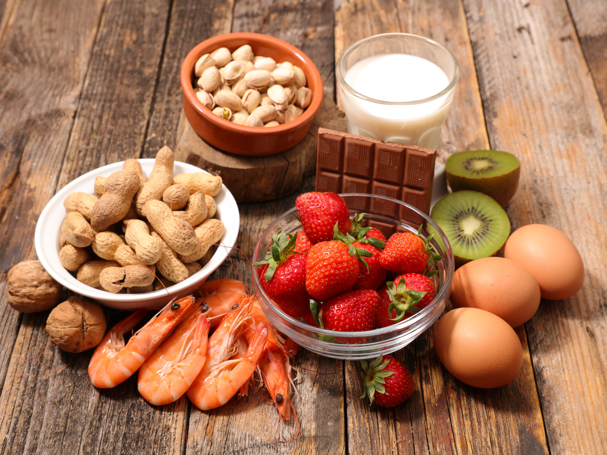 Food allergy and food intolerance - common food allergens